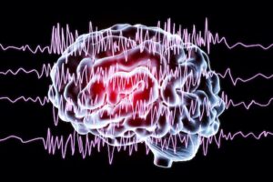 epilepsy training