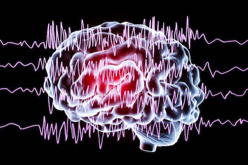 epilepsy training
